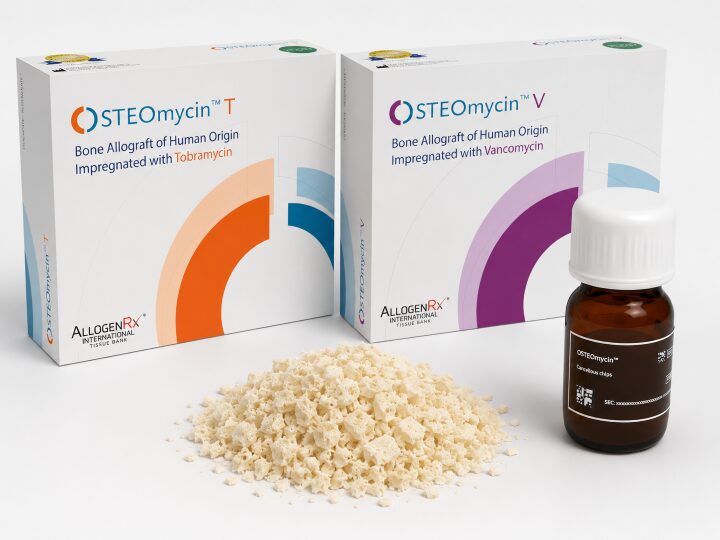 Chips óseos con antibiótico de origen humano